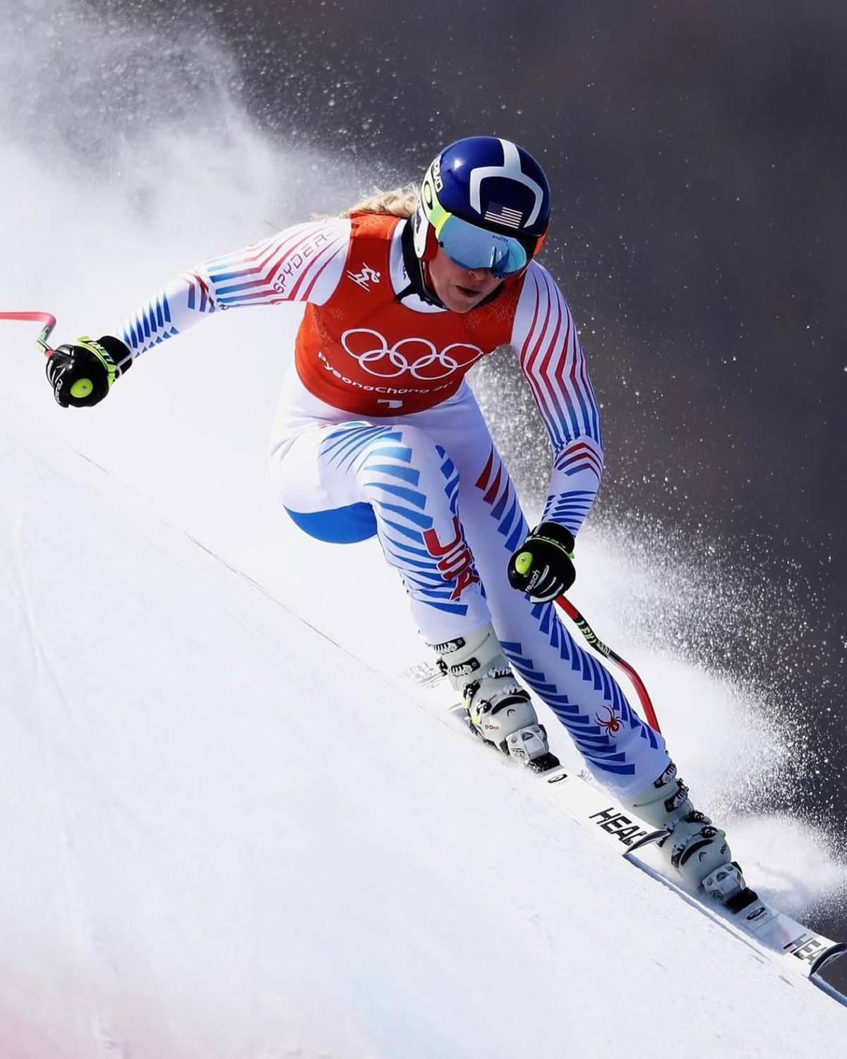 El incómodo descuido que sufrió famosa deportista en alfombra roja de los premios ESPYS
