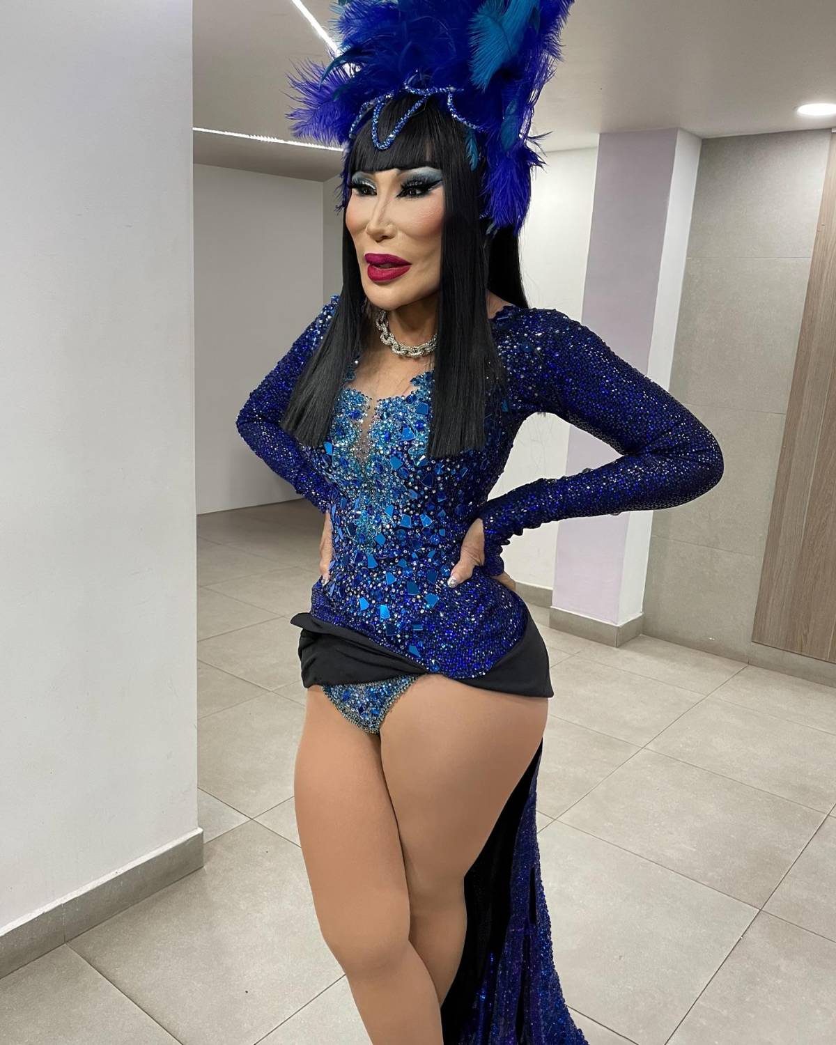 Triste testimonio: Lyn May revela por qué se deformó su rostro