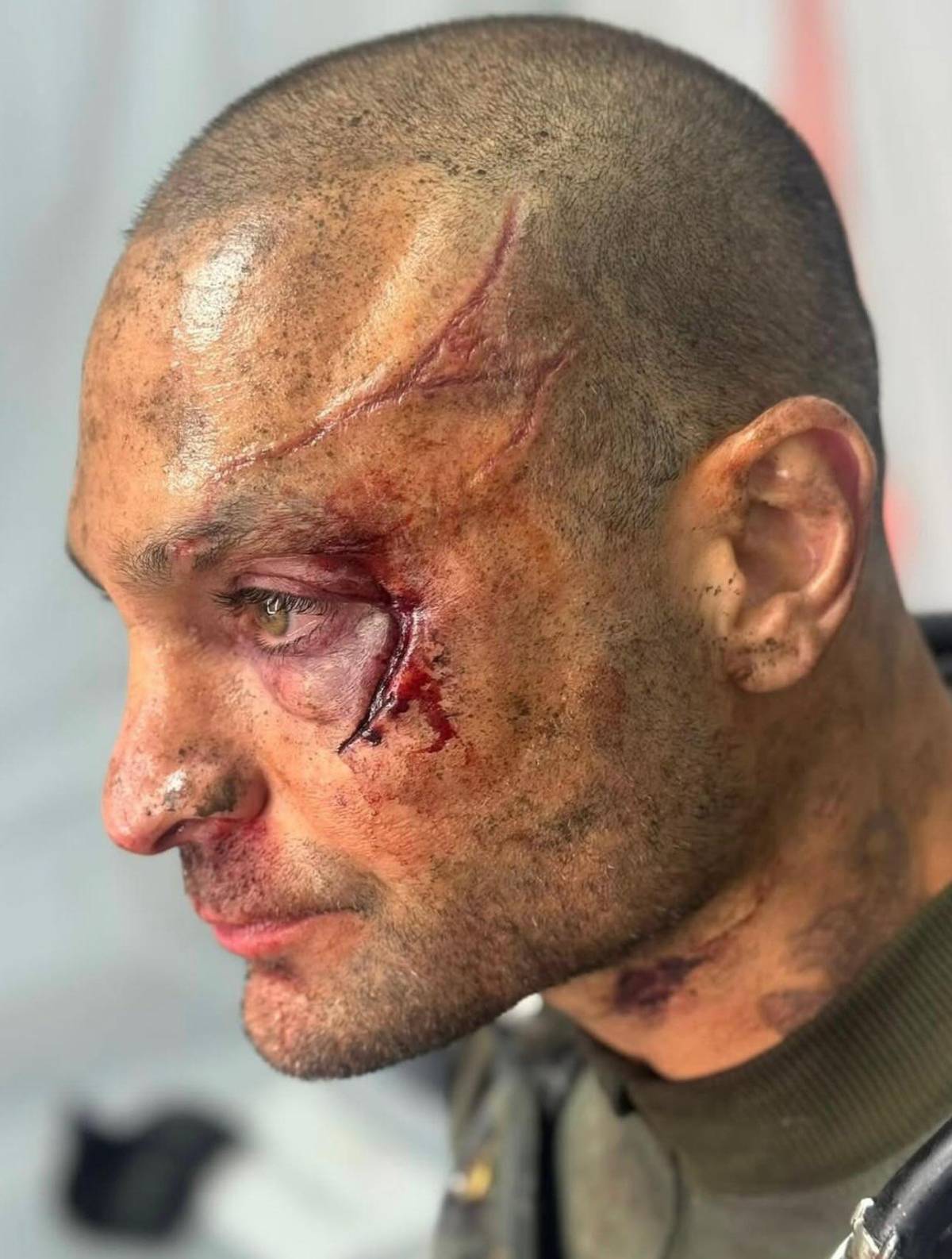 De los días sin hogar a Escorpión: la historia de Michael Mando
