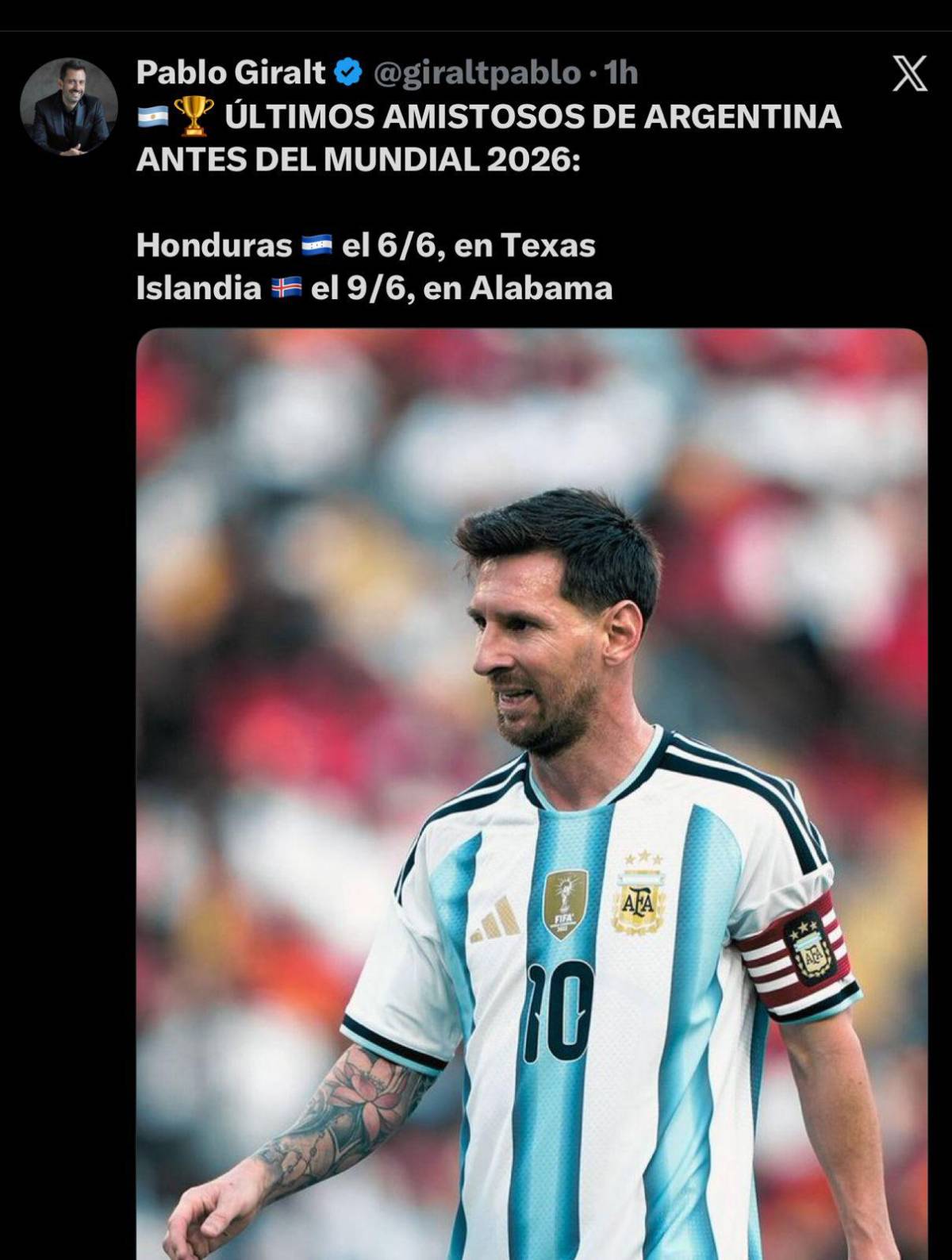 Esto dicen en Argentina por el amistoso vs Honduras; lanzan advertencia