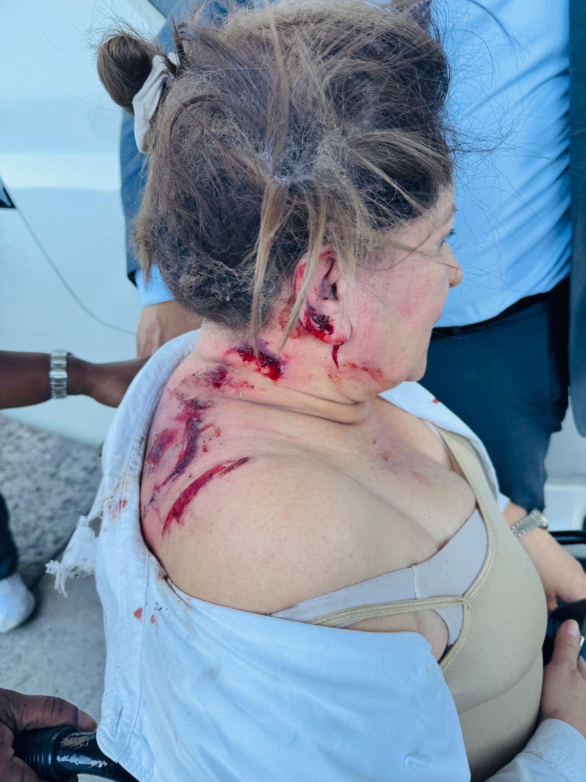 “Salí impulsada por los aires”: Gladis Aurora López relata momento de la agresión