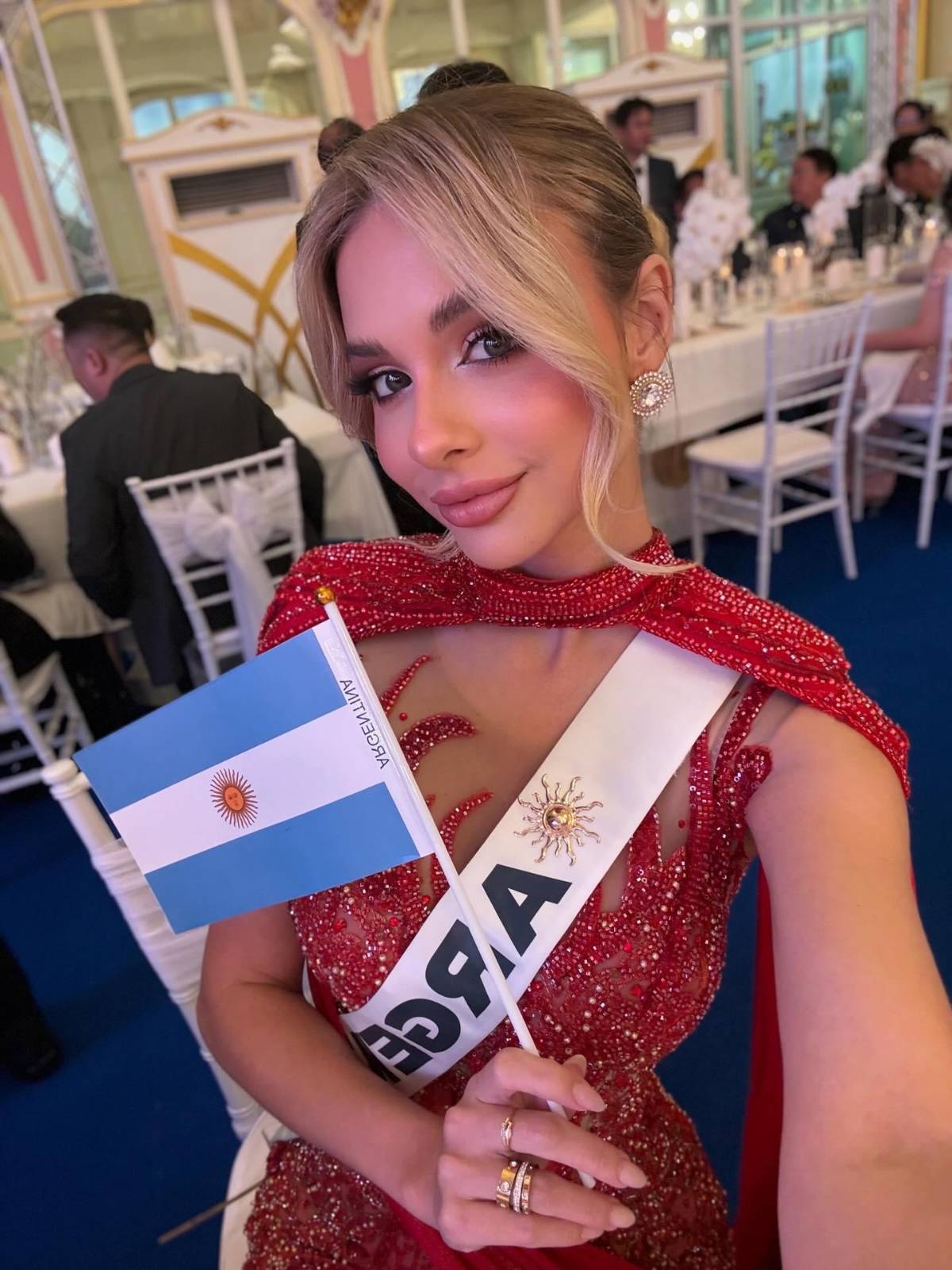 Miss Argentina 2025, Aldana Masset, revela que padece alopecia