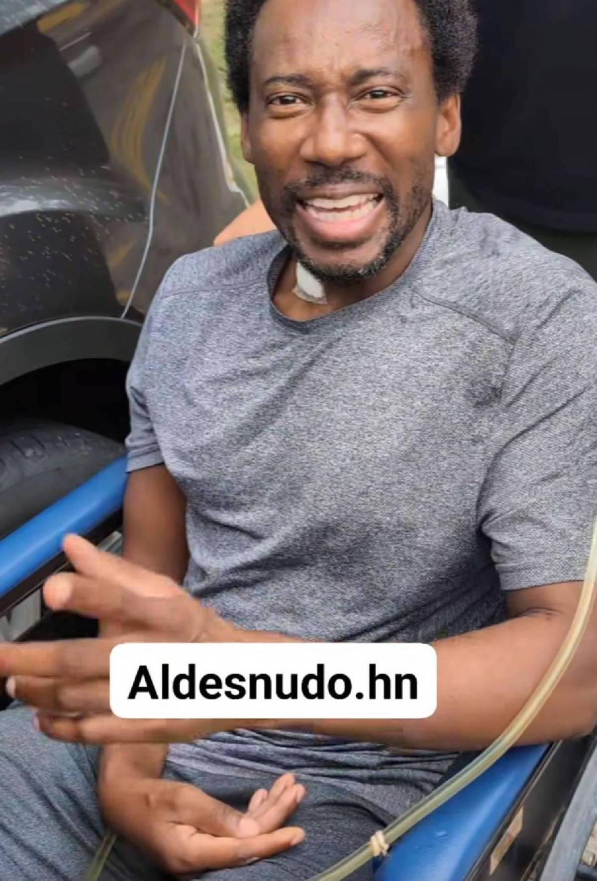 Limber Pérez reaparece: lo último sobre su estado de salud tras sufrir derrame cerebral