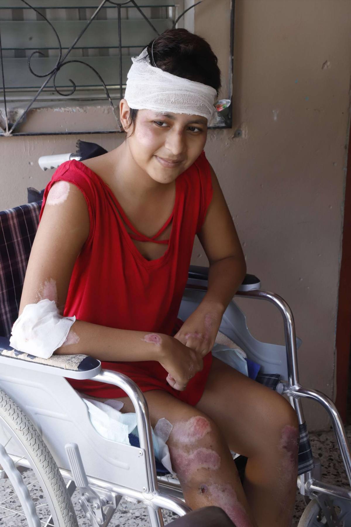 El calvario de Hazel: la sonrisa que no se borró a pesar de la tragedia