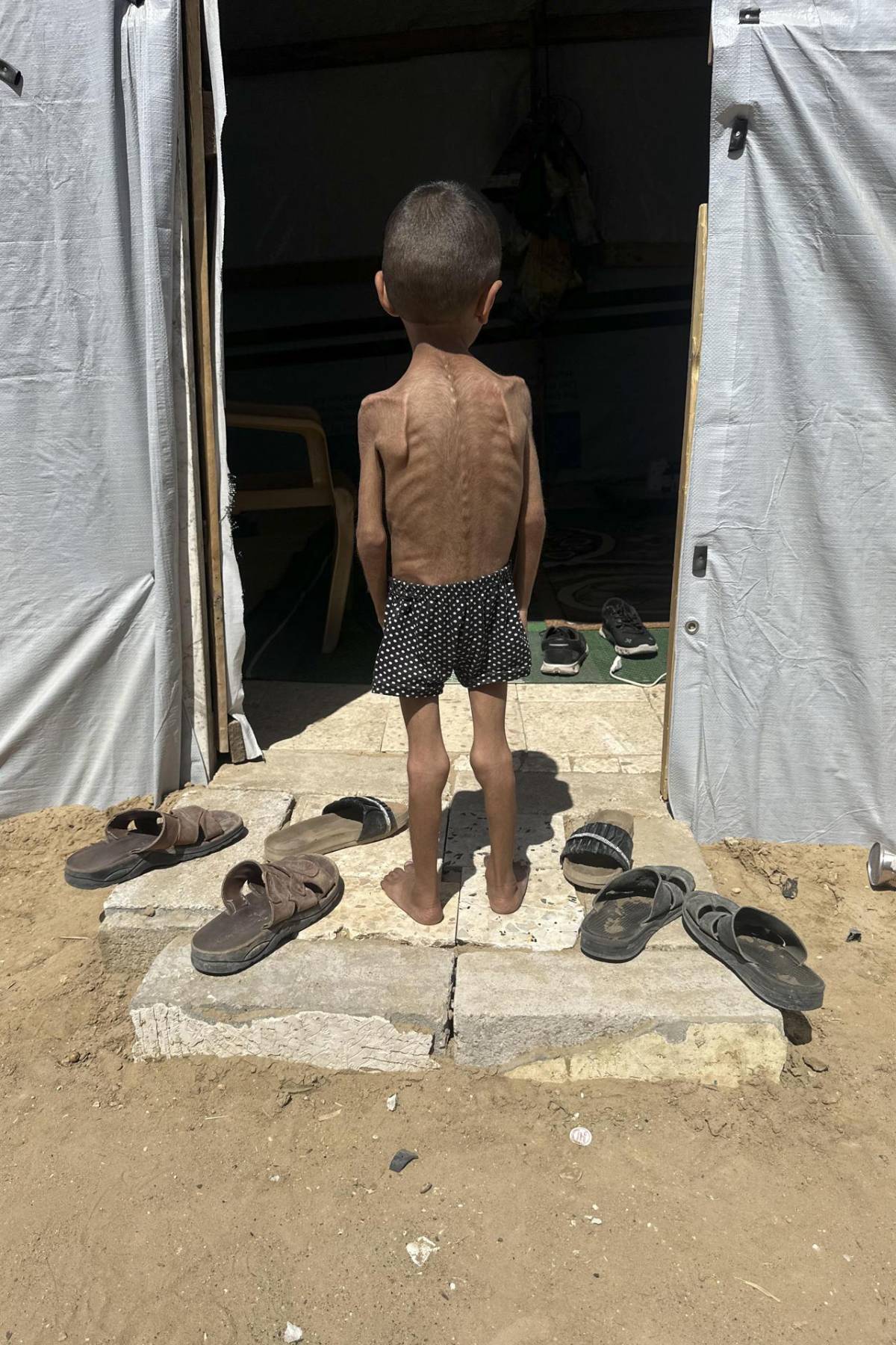 Gaza se muere de hambre: El bloqueo israelí agrava la crisis