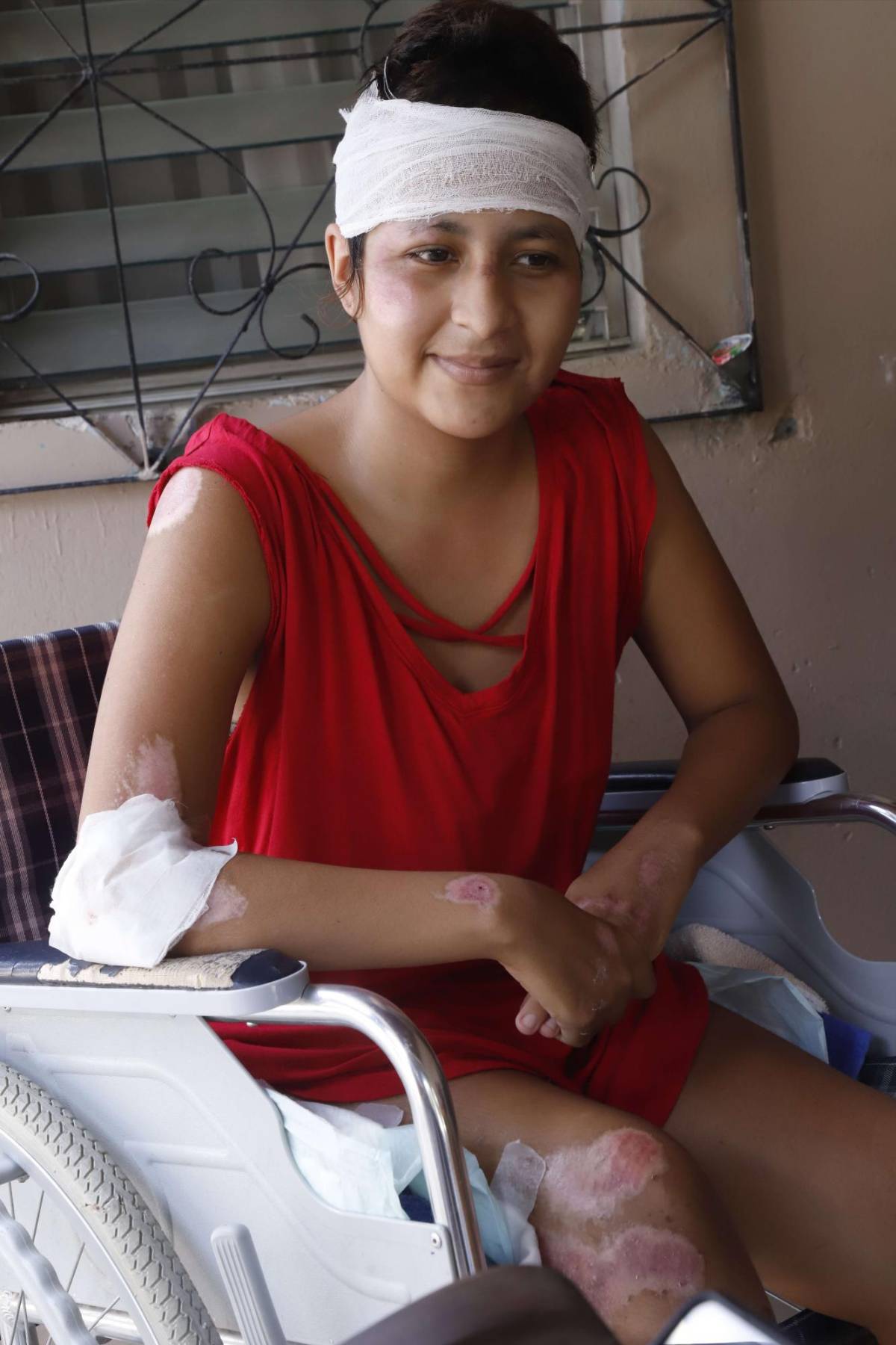 El calvario de Hazel: la sonrisa que no se borró a pesar de la tragedia