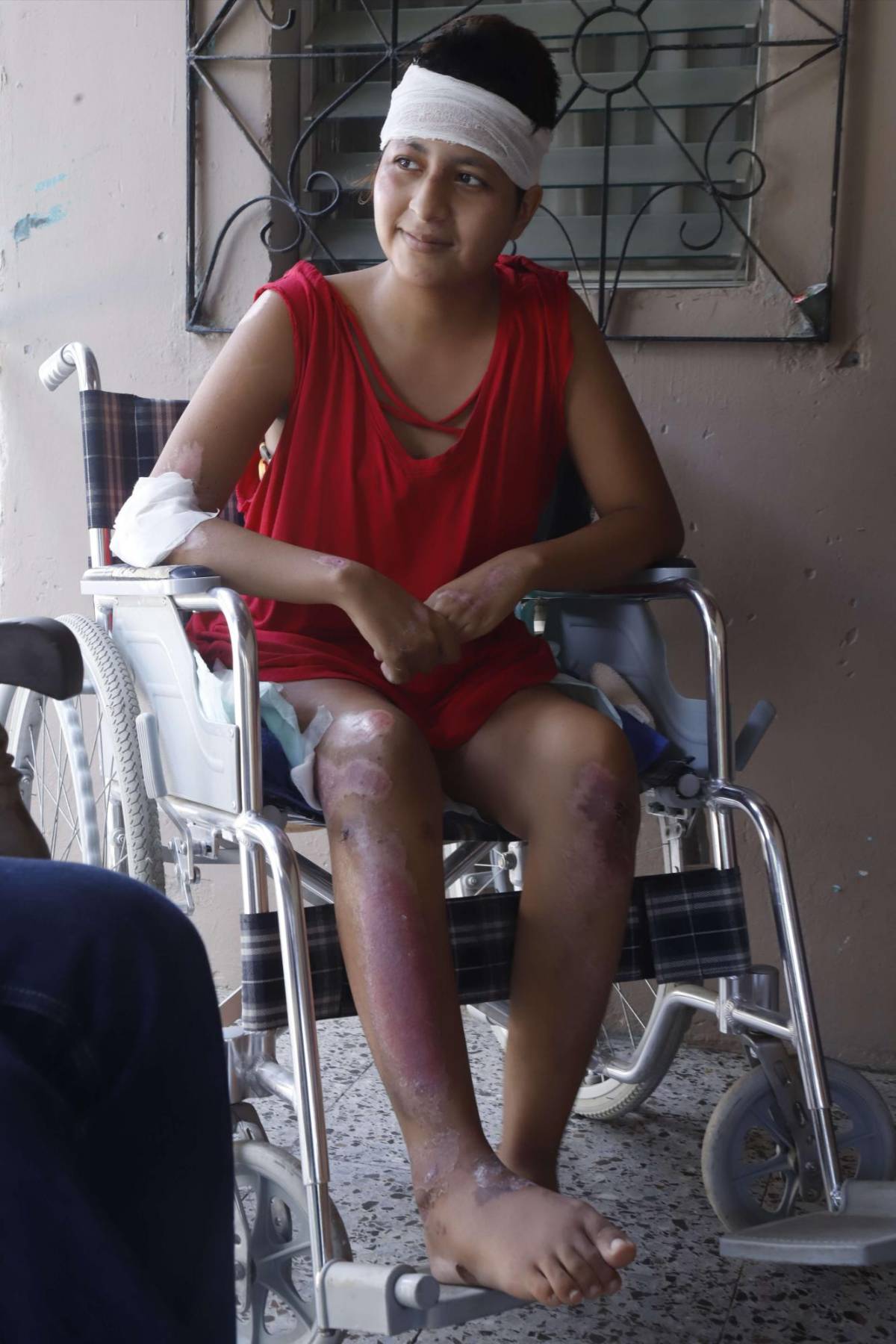 El calvario de Hazel: la sonrisa que no se borró a pesar de la tragedia