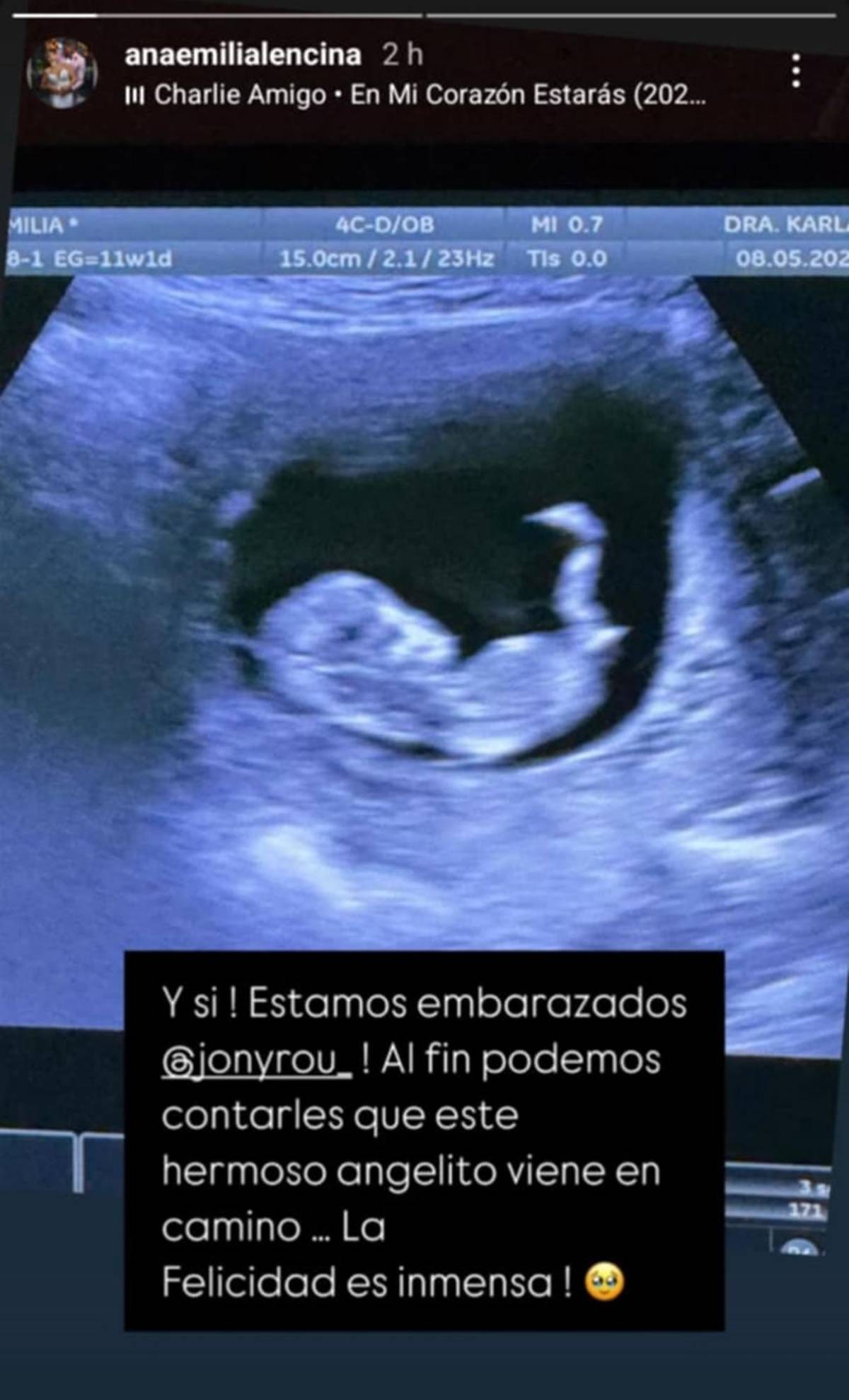 Bella argentina anuncia embarazo de futbolista de Liga Nacional de Honduras