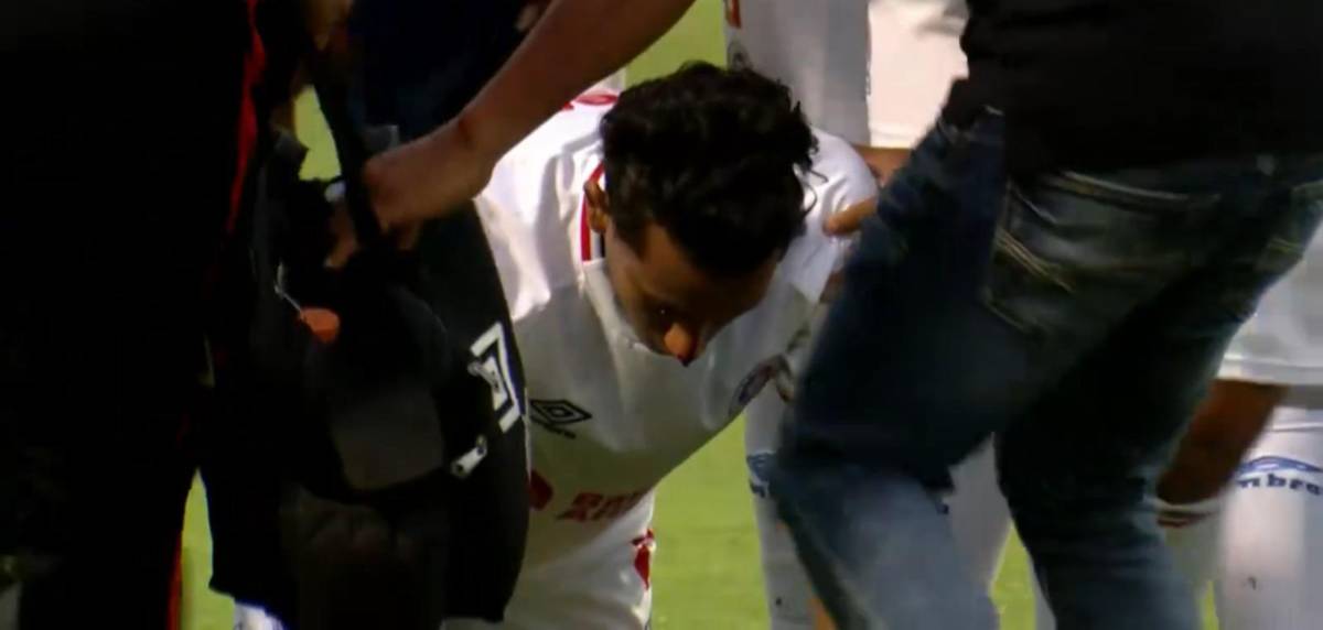 El increíble error de Menjívar vs Motagua, agresión a Edwin, sangre y baile en Olimpia