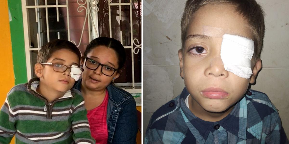 Menor hondureño necesita apoyo para pagar cirugía y rescatar su ojo
