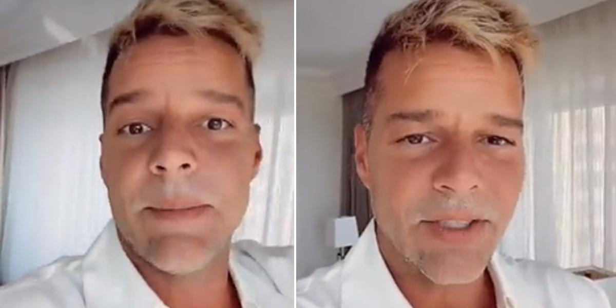 Ricky Martin: “No me he hecho nada en la cara”