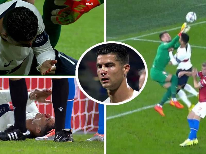 Cristiano Ronaldo sufrió un fuerte golpe en el rostro y terminó sangrando en el juego República Checa-Portugal.