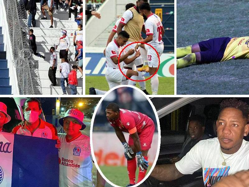 Las imágenes que dejó el primer partido de la final del Torneo Apertura 2021 que ganó el Olimpia (2-0) al Real España en el estadio Nacional con doblete de Jorge Álvarez.