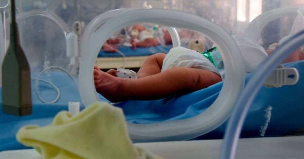 Brasil, el país más golpeado por la pandemia de coronavirus en Latinoamérica, también es el que mayor cifra de niños fallecidos registra en el mundo. Fotos AFP