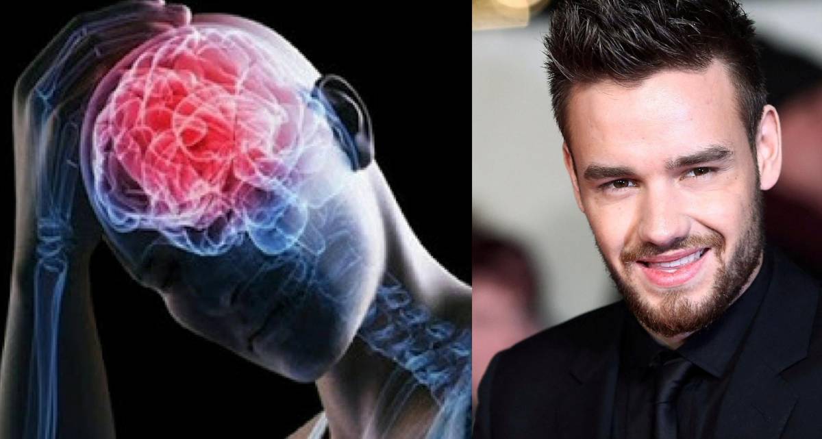 ¿Qué es un politraumatismo?, la causa de muerte de Liam Payne