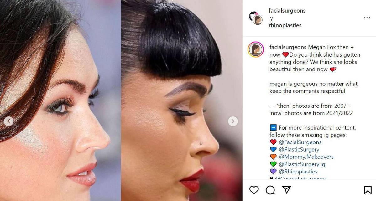 Megan Fox admitió que se sometió a una cirugía en la nariz, cuando era muy joven.