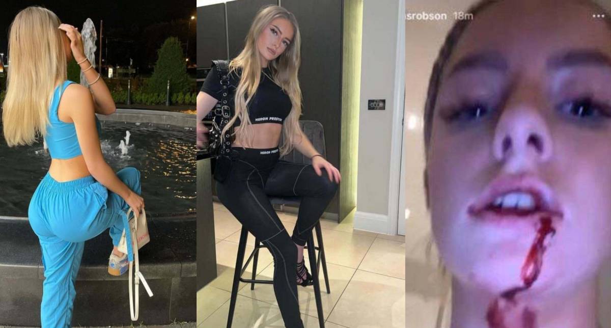 Harriet Robson es la novia de Mason Greenwood y compartió fotografías de supuestos actos de violencia que sufrió por parte del jugador inglés.