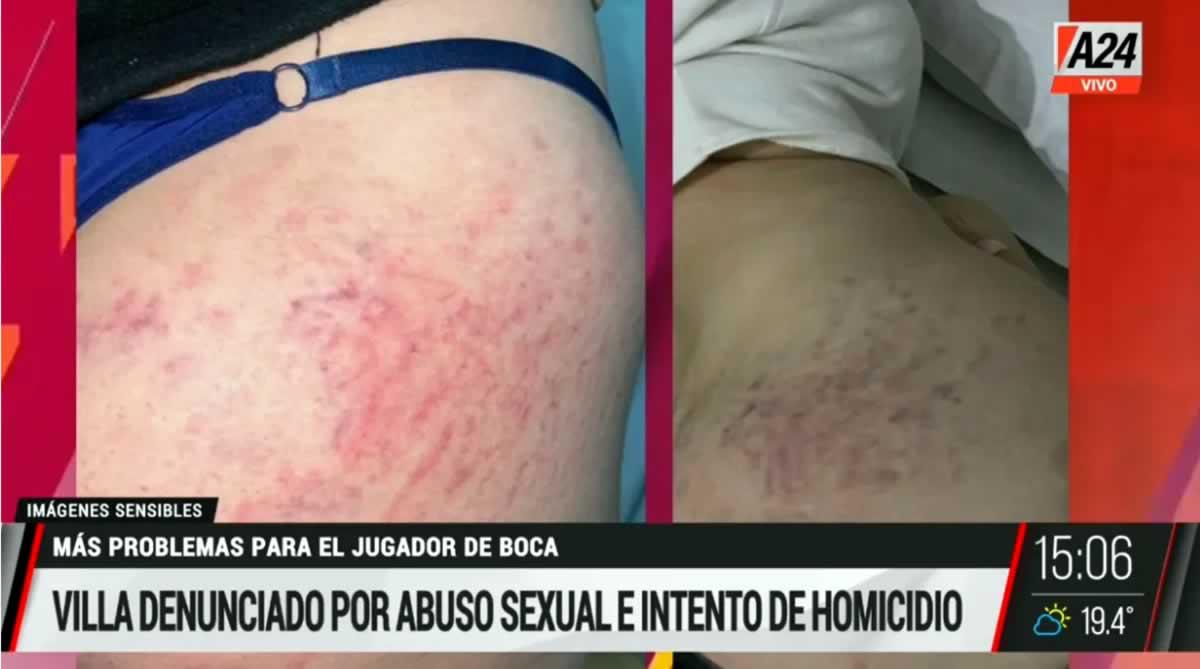 Las imágenes de la denuncia que mostró la mujer contra Sebastián Villa.