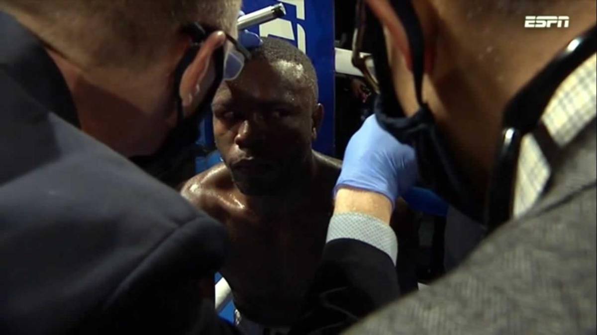 “Escorpión” Ruiz fue superado por su oponente.