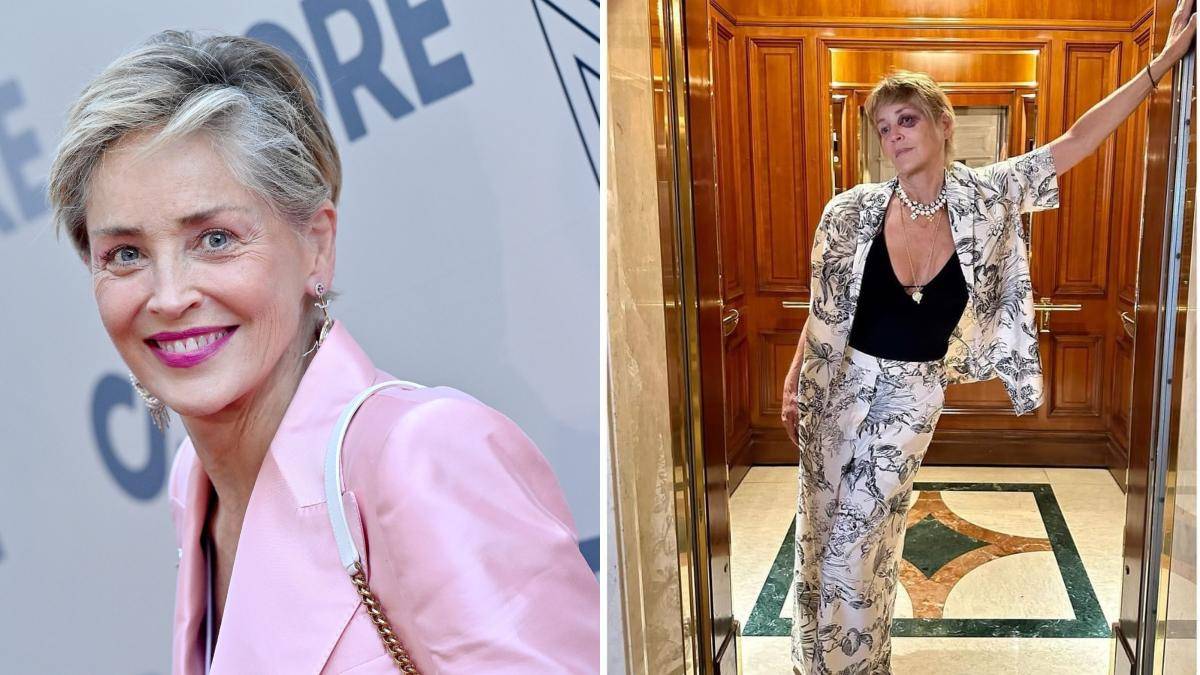 Sharon Stone revela detalles del fuerte hematoma en su rostro