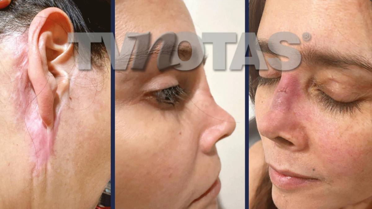 Dorismar queda “irreconocible” tras fallidos procedimientos estéticos