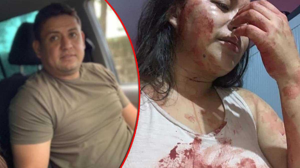 Joven hondureña denuncia a su expareja por intentar asesinarla a ella y a su madre