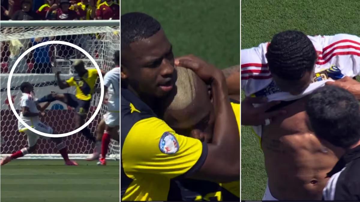 Criminal patada: Enner Valencia, primer expulsado de la Copa América-2024