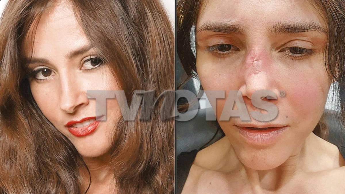 Dorismar queda “irreconocible” tras fallidos procedimientos estéticos