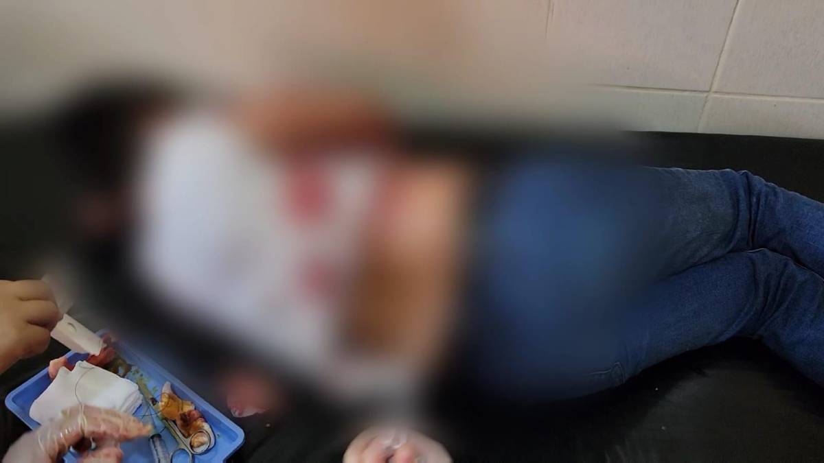 Pitbull ataca a niño de 8 años en San José, Copán