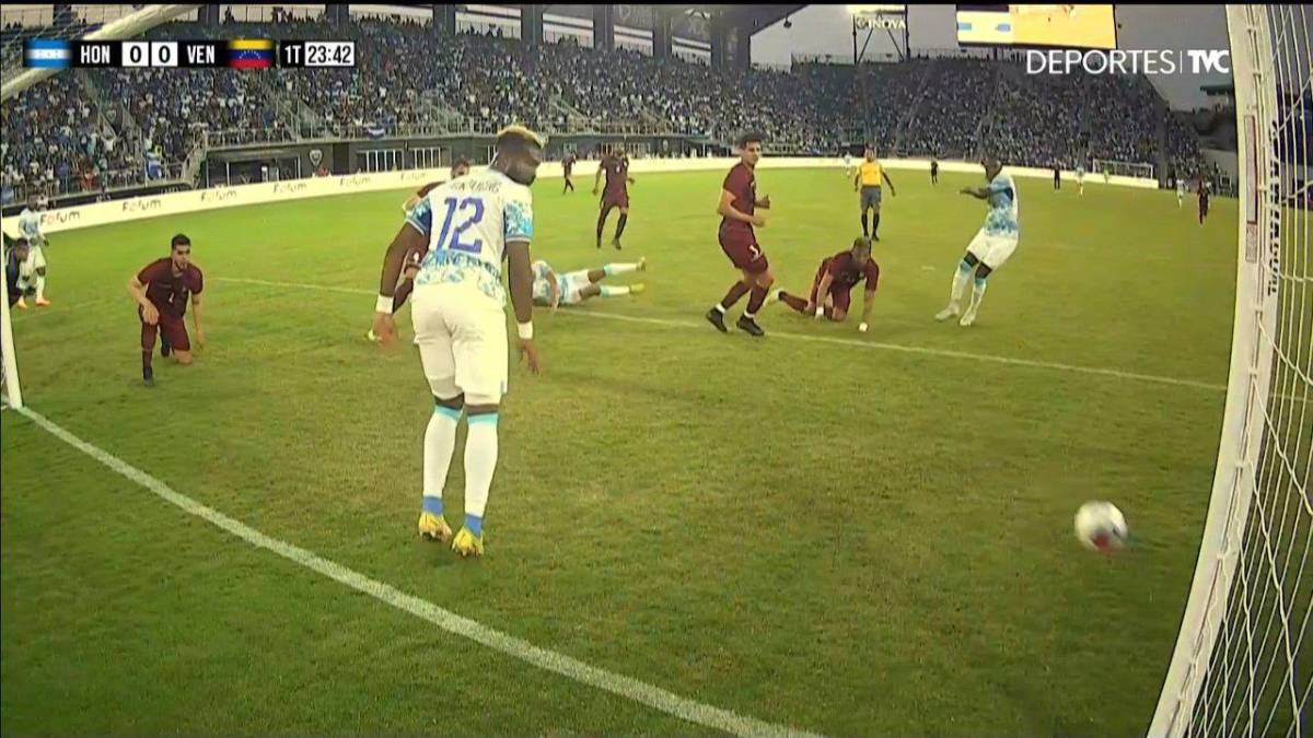 La terrible definió de Alberth Elis.