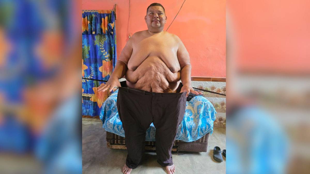 Así cambió la vida de Elder Castillo tras perder más de 500 libras