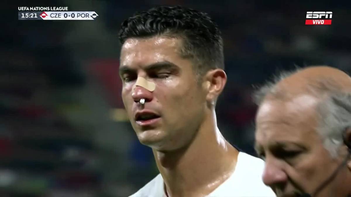 Fotos: El susto de Cristiano Ronaldo tras impactante golpe recibido en el rostro