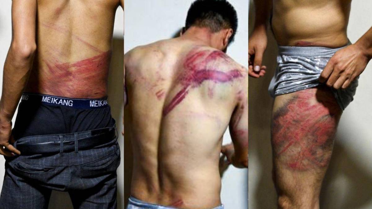FOTOS: Cuatro horas infernales vivieron periodistas al ser torturados por talibanes en Kabul