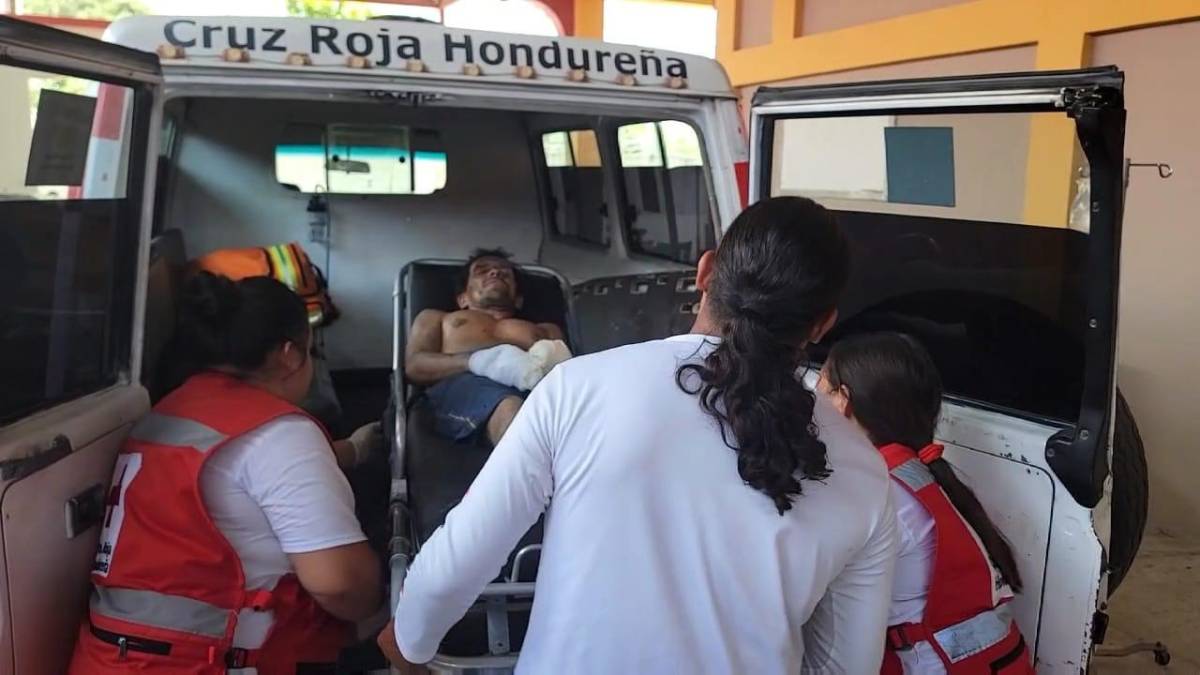 Hombre sufre mutilación en manos haciendo cohetes en Copán
