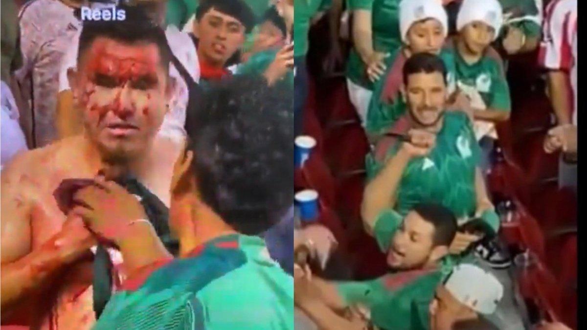 Copa Oro 2023: Duro relato de aficionado que fue apuñalado en el México- Qatar