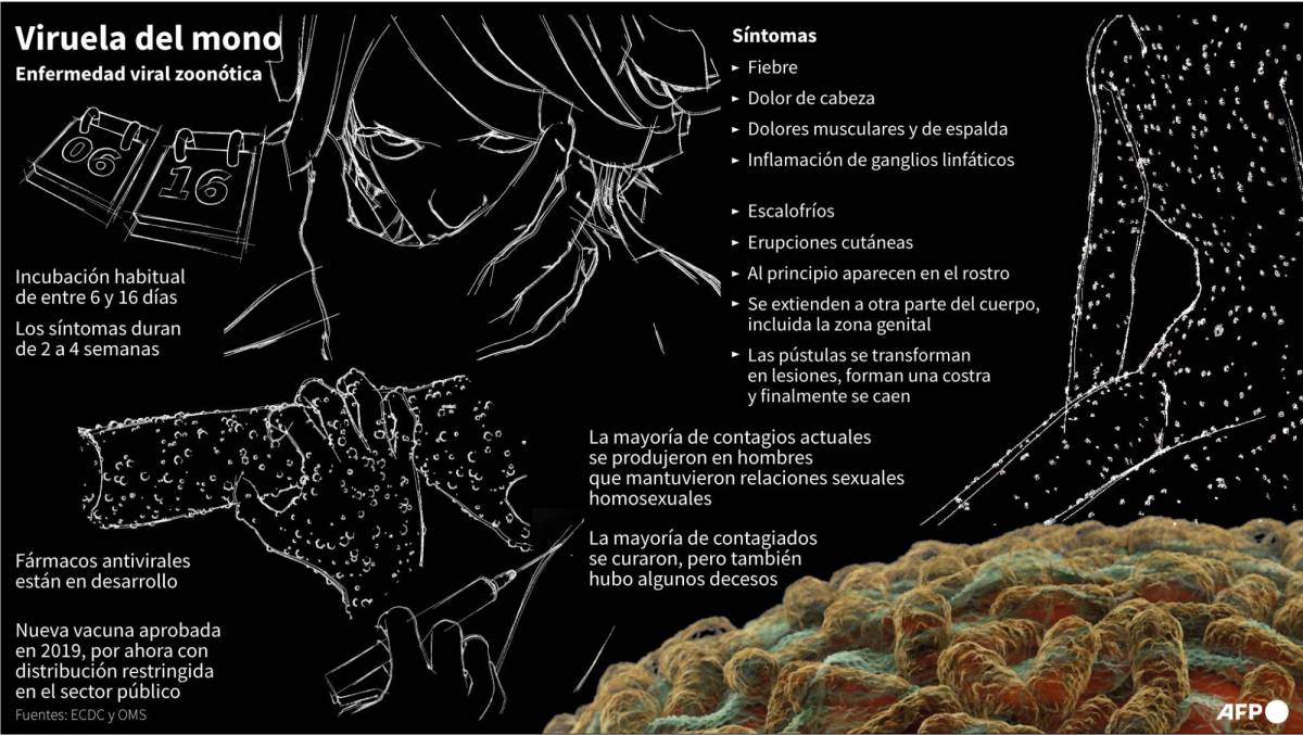 Texas registra la primera muerte en Estados Unidos con viruela del mono