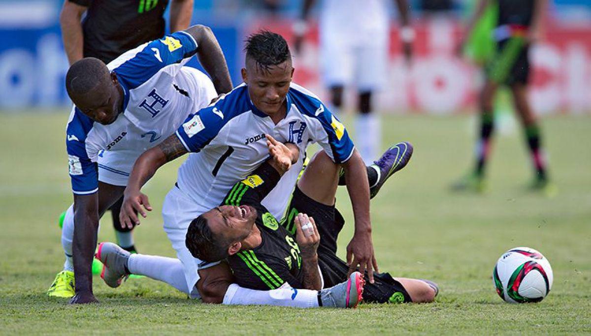 Luis Garrido sufrió una de las peores lesiones que se recuerdan en el fútbol.