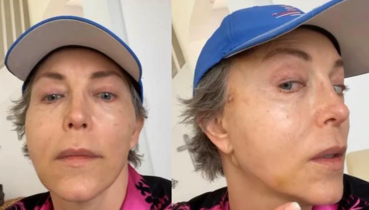 ¡Bellísima! Laura Flores impacta con su aspecto rejuvenecido