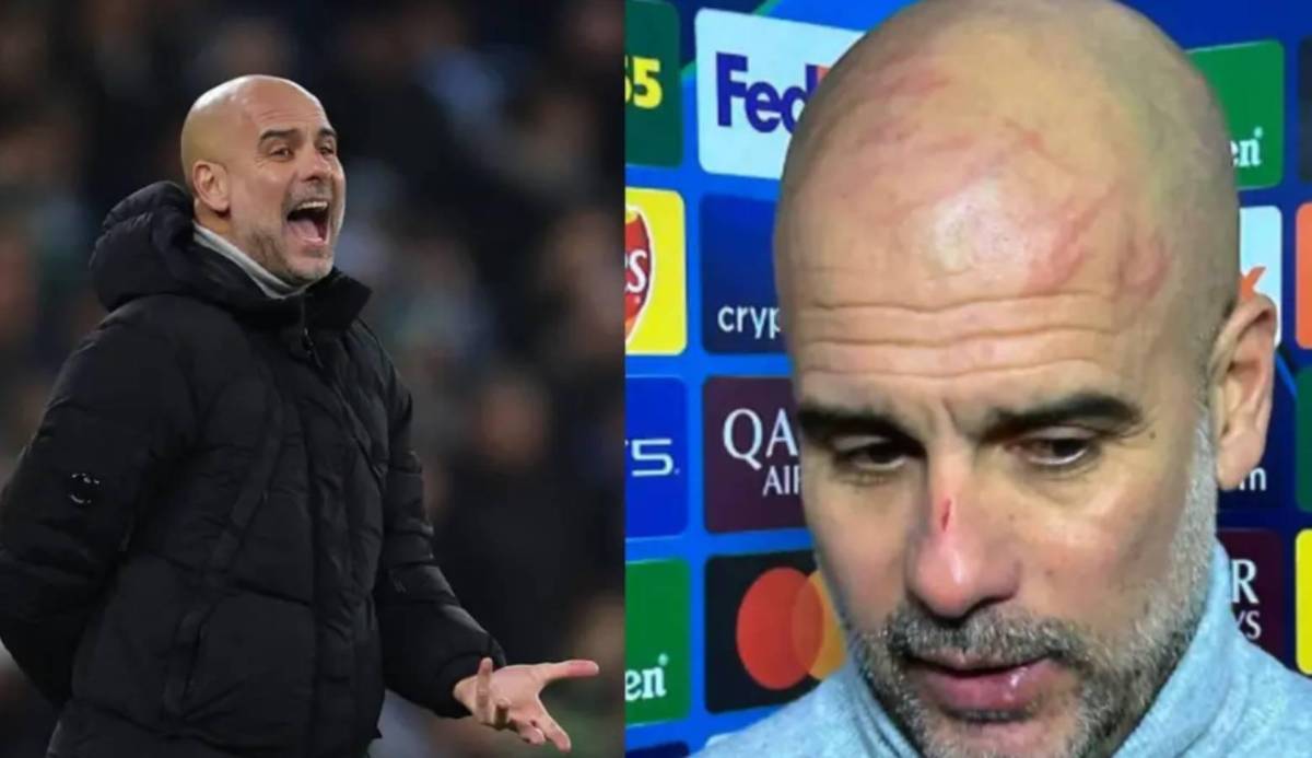 Pep Guardiola sin rodeos: Motivos de sus arañazos y crisis del Manchester City