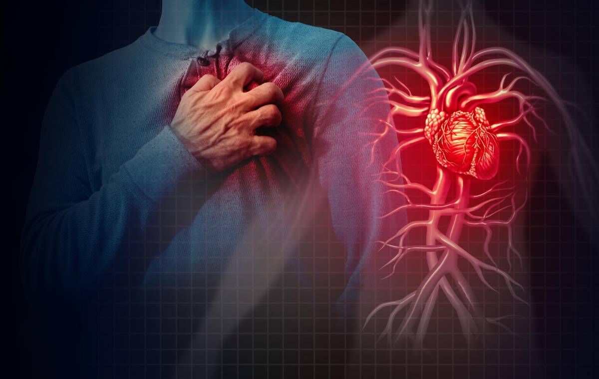 Estenosis e insuficiencia cardiaca, dos males que se confunden con infartos