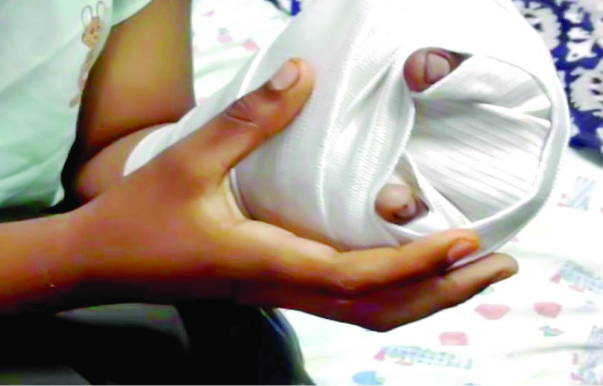 Hospitales suman cuatro adultos y 14 niños quemados por pólvora