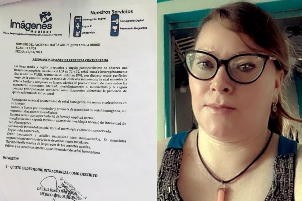 Joven hondureña pide ayuda para una operación cerebral