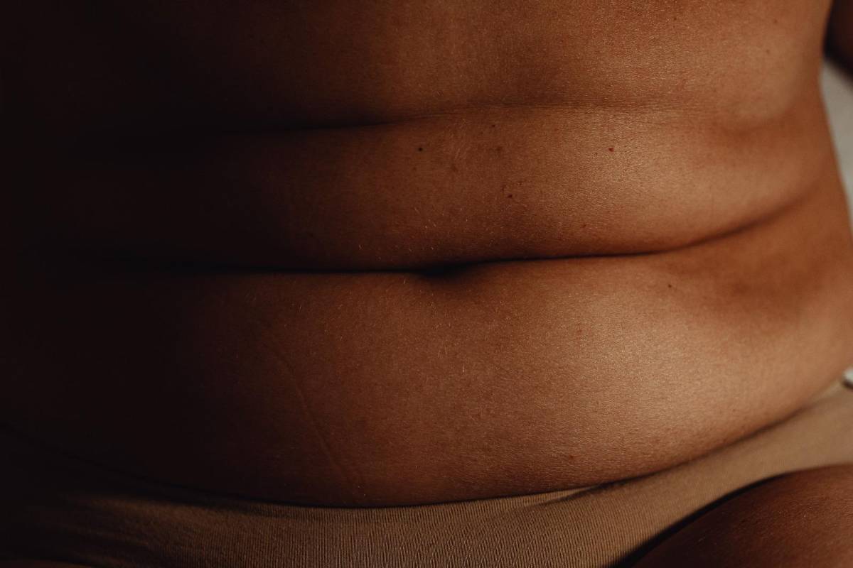 ¿Belleza sin límites? Usan grasa de donantes fallecidos para esculpir cuerpos