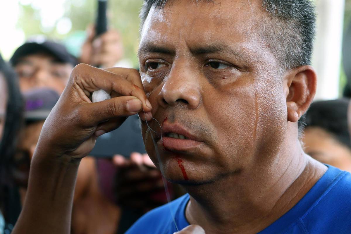 Migrantes en caravana se suturan labios para presionar al Gobierno de México