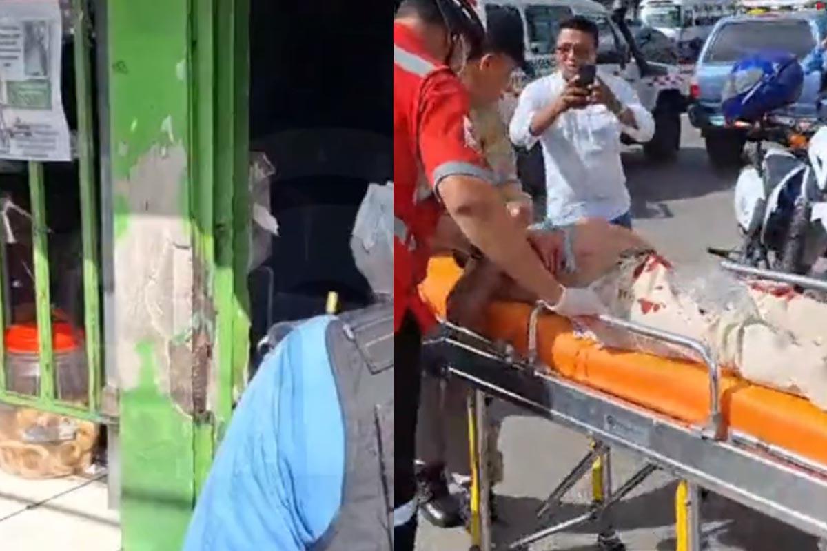 Sicarios tirotean a dueño de pulpería en El Carrizal