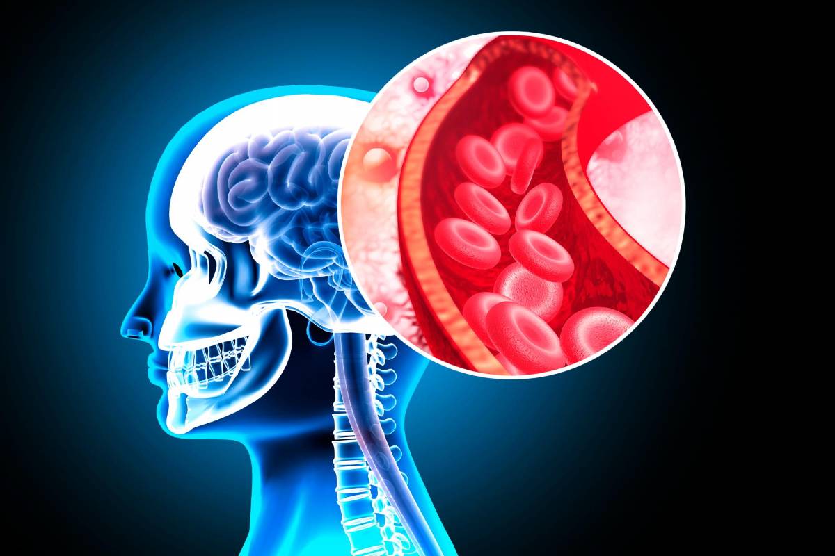 Cuidar dientes y encías ayuda a proteger el cerebro