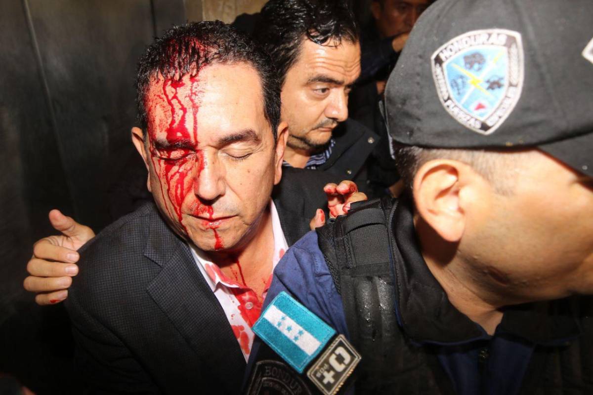 El diputado Antonio Rivera Callejas sufrió una agresión.