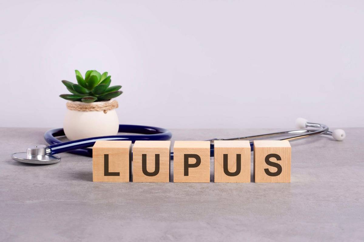 Lupus, origen, síntomas y qué hacer si la padeces