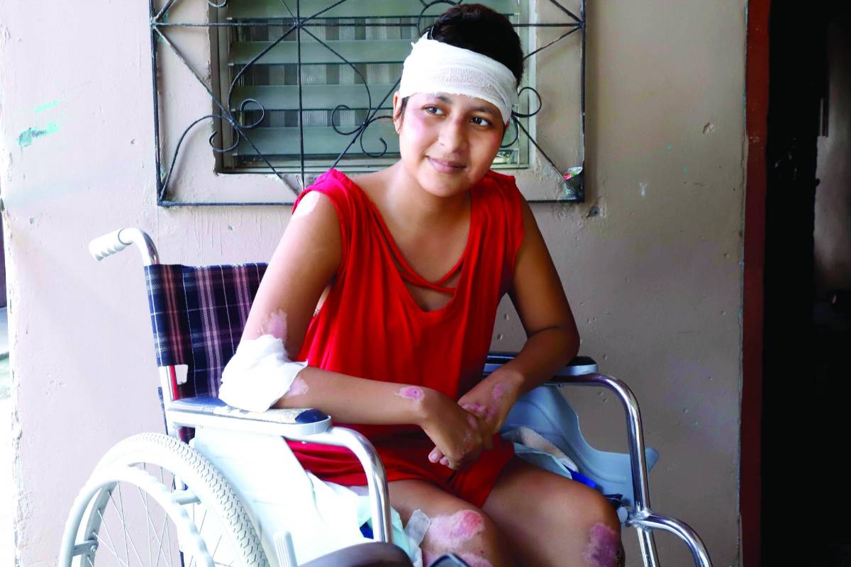 Hazel Cortés se recupera de las lesiones.