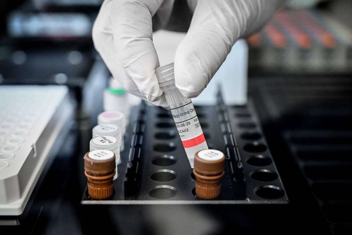 ¿Cuánta luz ultravioleta se necesita para inactivar el covid-19?